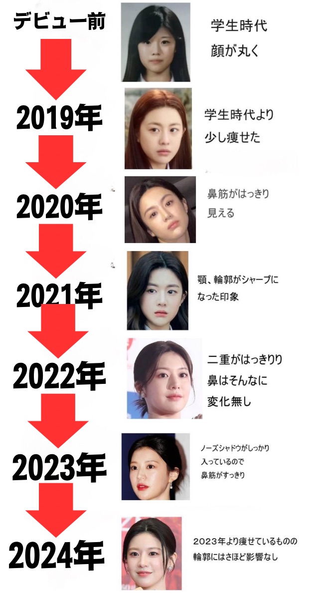 コユンジョンの整形説について顔の変化を早見表