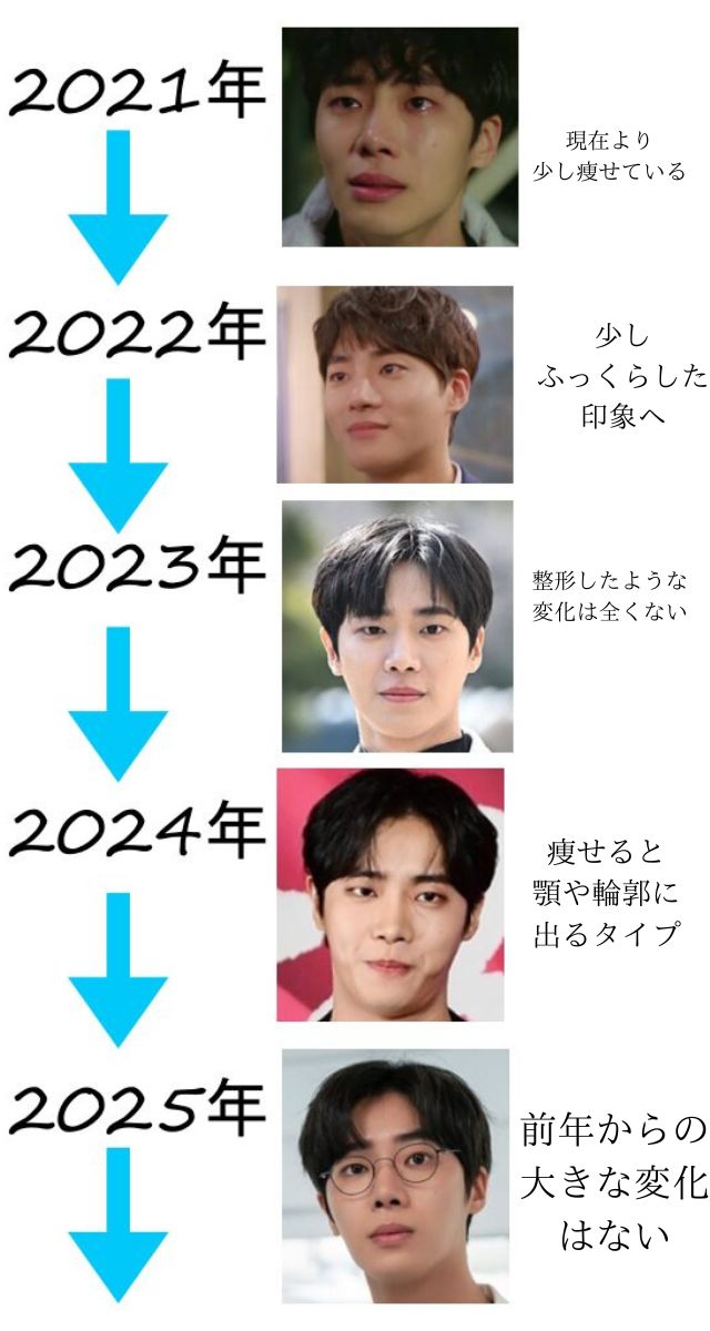 チュヨンウの整形疑惑検証の早見年表
