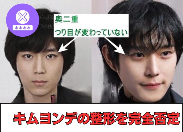 キムヨンデの整形疑惑についての検証結果