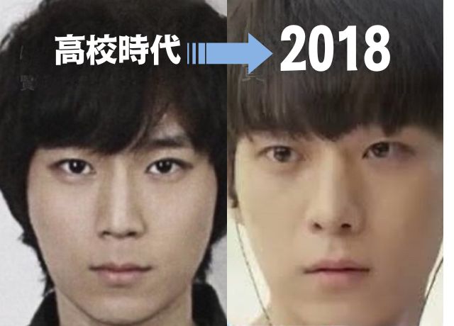学生時代と2018年のキムヨンデの整形疑惑の比較画像