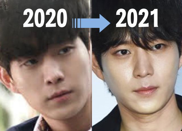 2020年と2021年のキムヨンデの整形疑惑の比較画像