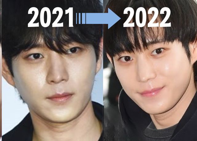 2021年と2022年のキムヨンデの整形疑惑の比較画像