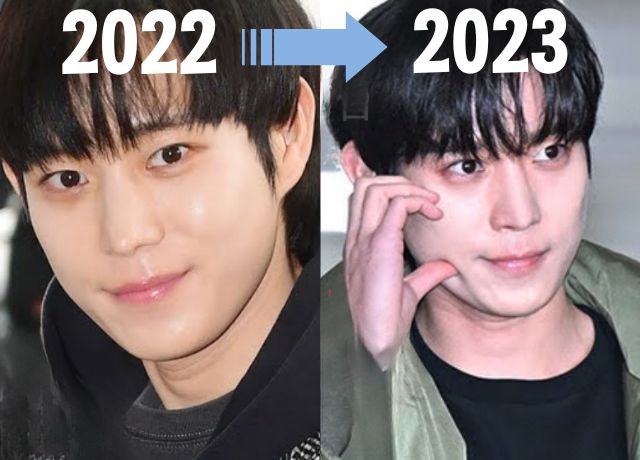 2022年と2023年のキムヨンデの整形疑惑の比較画像