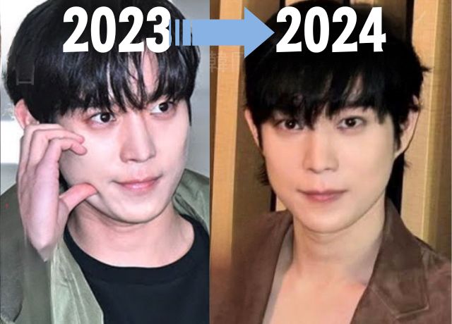 2023年と2024年のキムヨンデの整形疑惑の比較画像