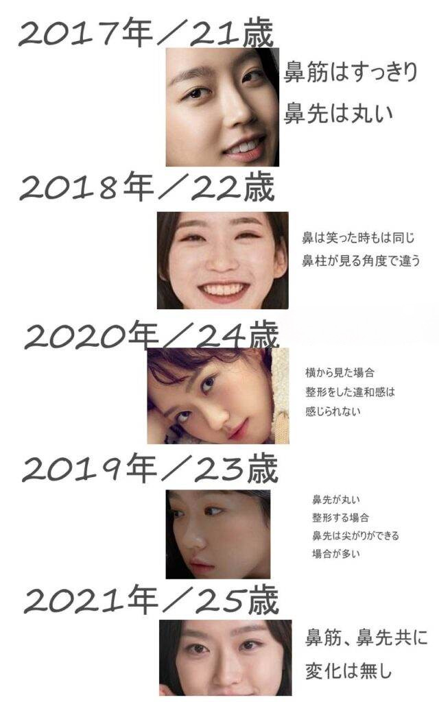 ハンジヒョンの鼻の早見年表