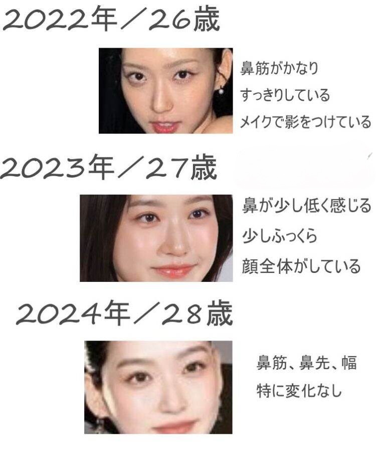 ハンジヒョンの鼻の早見年表