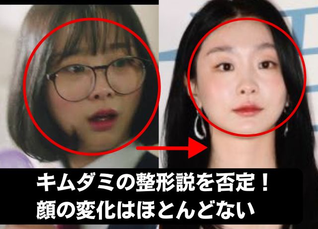 キムダミの整形検証画像の結果、整形はしていない