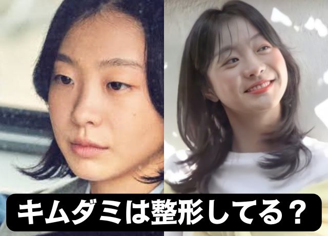 キムダミは整形していない!