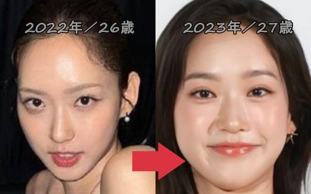 ハンジヒョンの整形比較画像