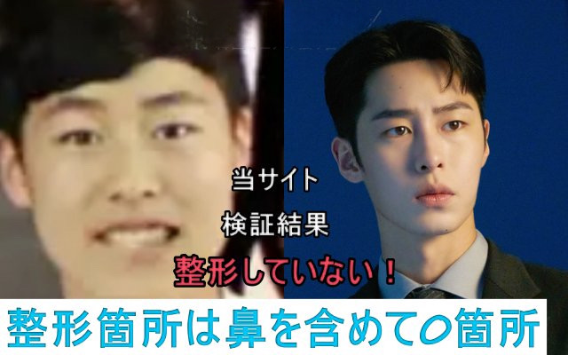 イジェウクの整形比較画像の検証結果