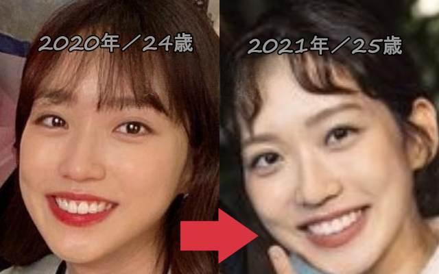 ハンジヒョンの整形比較画像
