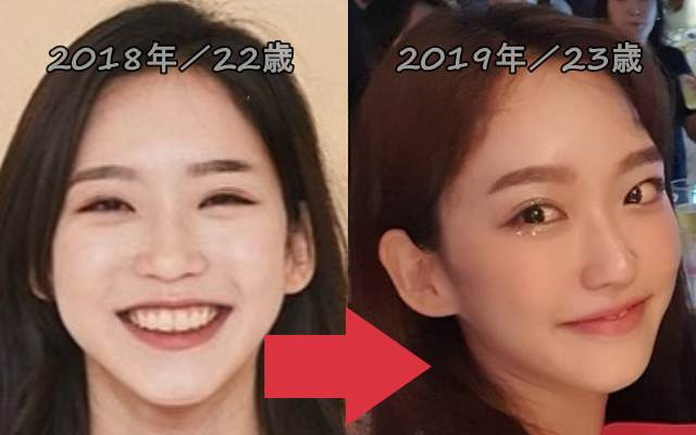 ハンジヒョンの整形比較画像