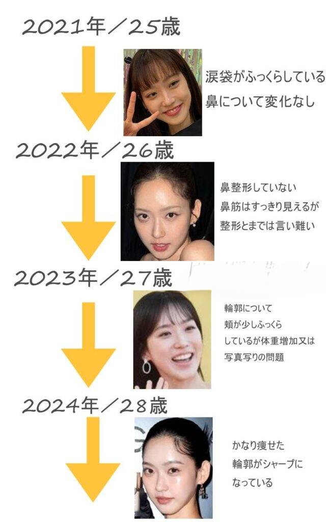 ハンジヒョンの顔全体の整形についての早見年表