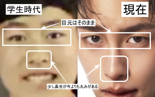 イジェウクの鼻の比較画像