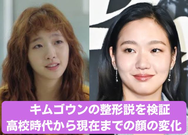 キムゴウンの整形説を検証!昔から現在までの顔の変化