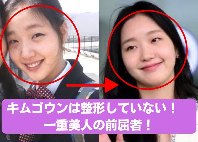 キムゴウンの整形検証画像結果では、整形していない