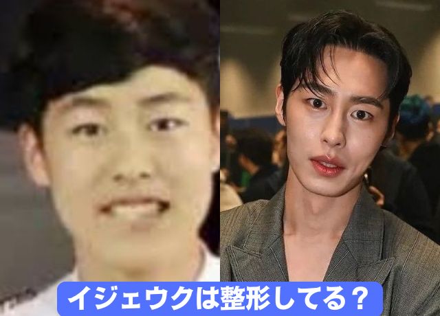 イジェウクの整形比較画像