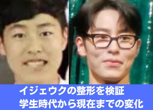 イジェウクの整形比較画像を検証