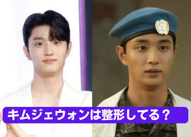 キムジェウォンは整形していない