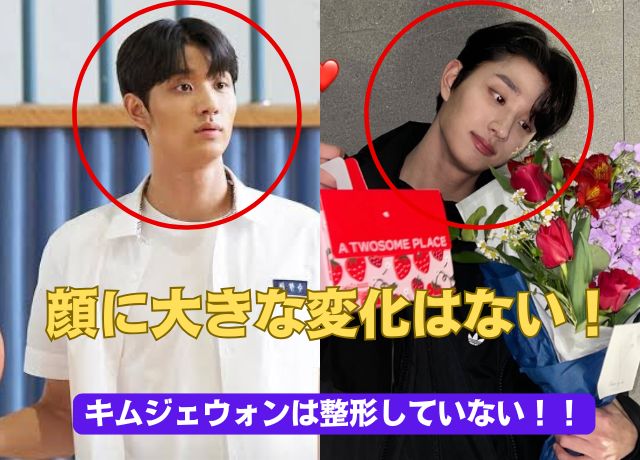 キムジェウォンの整形比較画像について