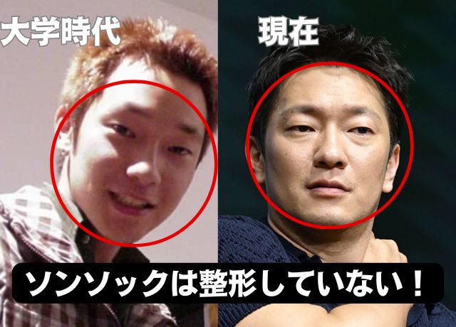 ソンソックの若い頃と現在の比較画像