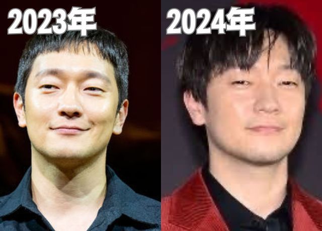 ソンソック2023年〜2024年の整形検証画像