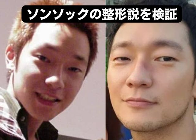 ソンソックの整形疑惑を年代順に検証