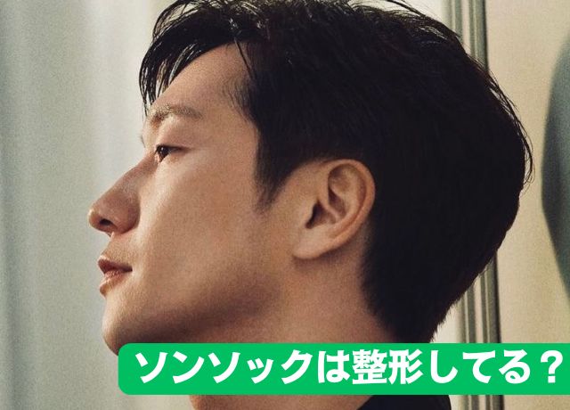 ソンソックは整形していのるか？