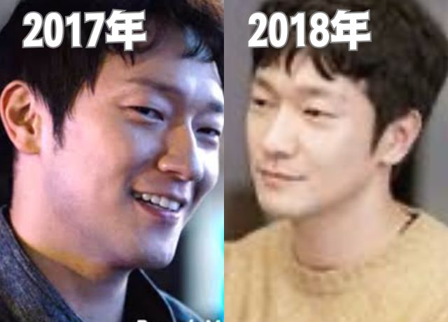 ソンソック2017〜2018年の整形検証画像