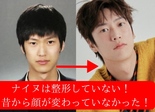 ナイヌの顔の変化から見る整形説検証結果　整形はしていない
