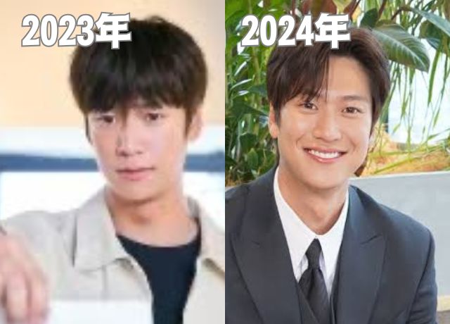 2023年と2024年のナイヌの顔の変化で整形説を検証