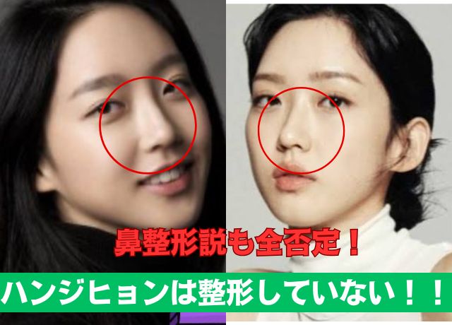 ハンジヒョンの整形比較画像