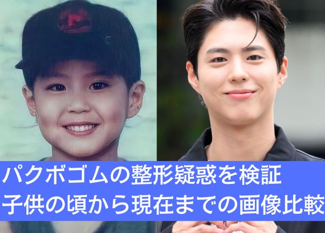 パクボゴム整形疑惑について更に詳しく年代順に画像比較