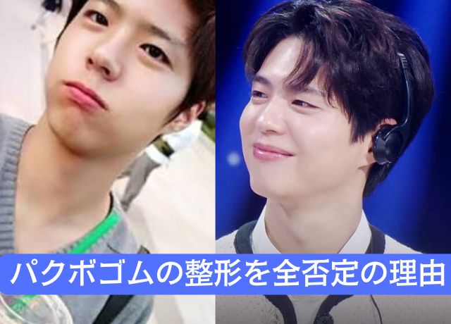 パクボゴムの整形疑惑を完全否定できる理由