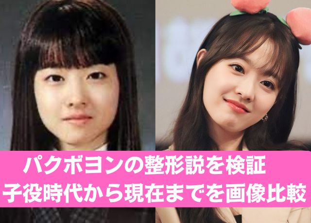 パクボヨンの整形疑惑を検証