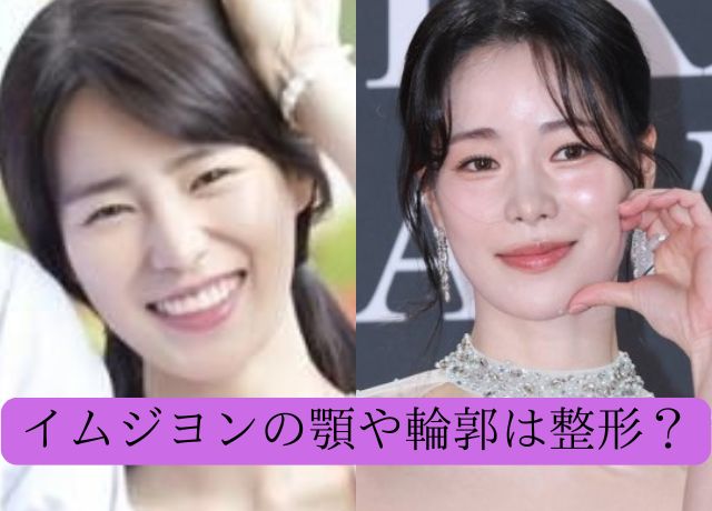 イムジヨンの整形が怪しいのは顎や輪郭？