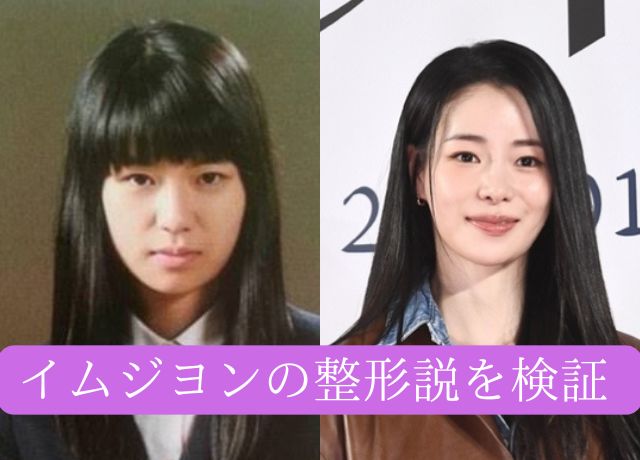 イムジヨンの整形について年代順に画像検証