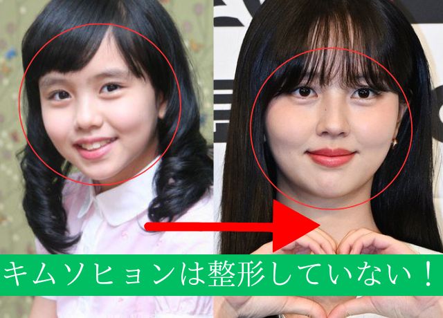 キムソヒョンの整形検証結果