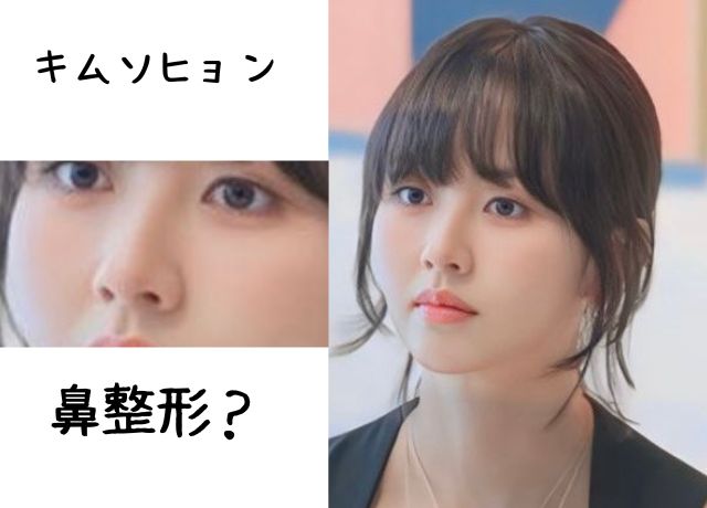 キムソヒョンは鼻整形が怪しい?