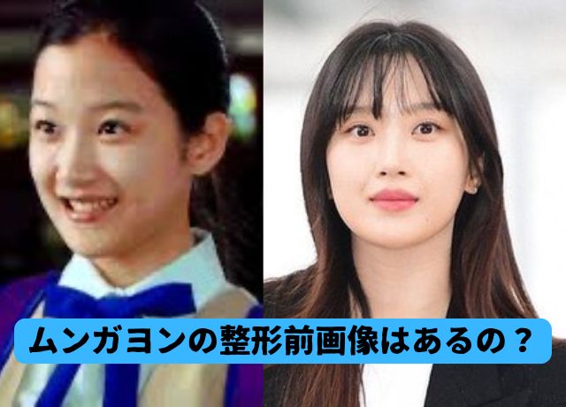 ムンガヨンは整形してる？