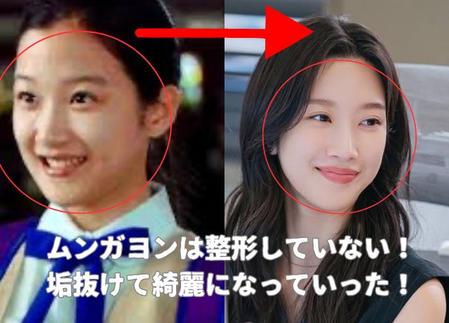 ムンガヨンの整形検証結果