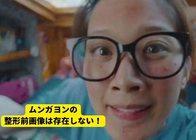 ムンガヨンの整形前画像があるの？