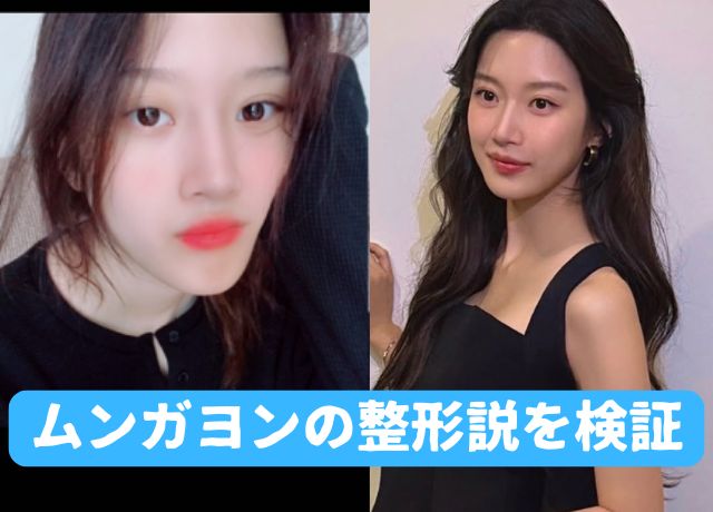 ムンガヨンの整形について顔の変化を年代順に検証