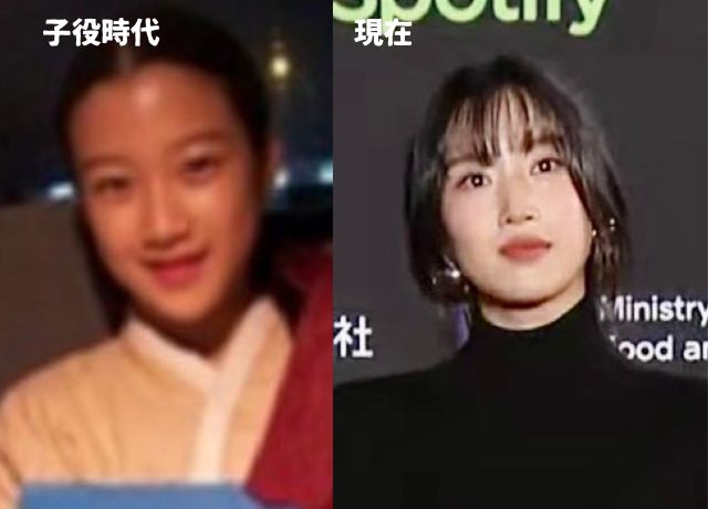 ムンガヨンの整形検証画像