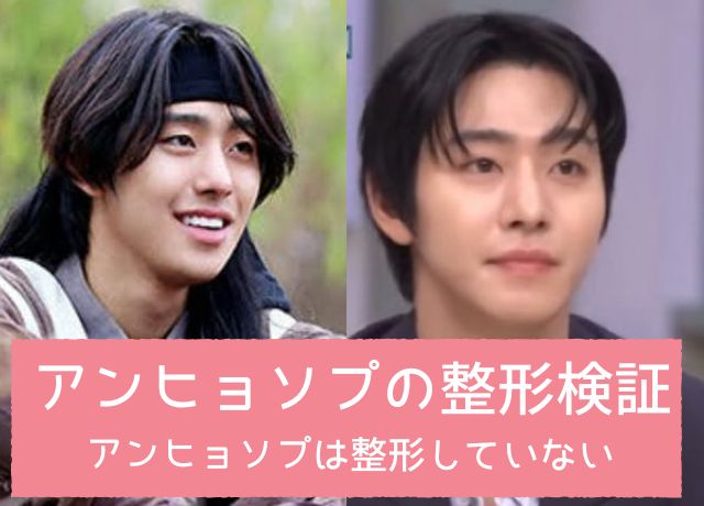 アンヒョソプの整形検証