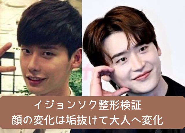 イジョンソクの整形検証結果
