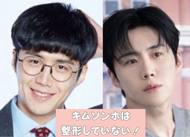 キムソンホの整形について