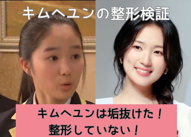 キムヘユンの整形検証結果