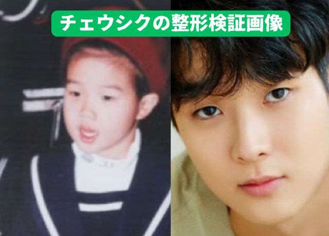 チェウシクの整形について幼少期から現在までの顔の変化を検証