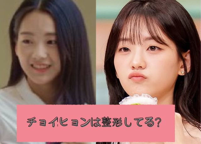 チョイヒョンは整形してる？